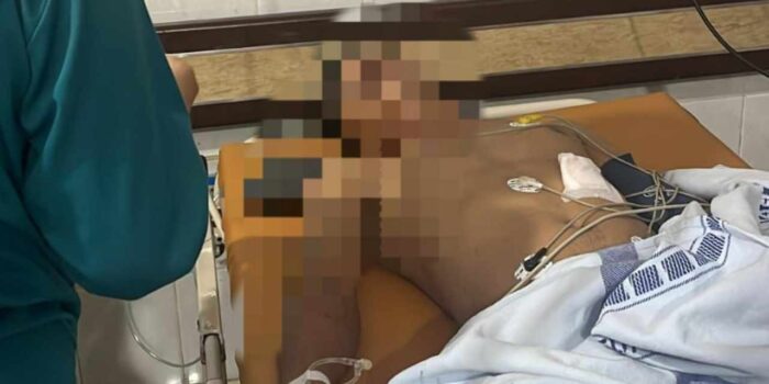 Petugas kepolisian menangani lokasi dugaan penembakan terhadap dua warga di kawasan Seberang Ulu I, Palembang.