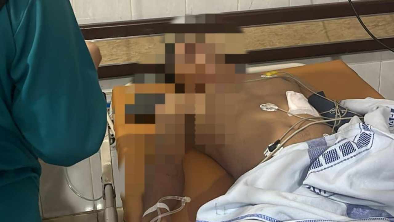 Petugas kepolisian menangani lokasi dugaan penembakan terhadap dua warga di kawasan Seberang Ulu I, Palembang.